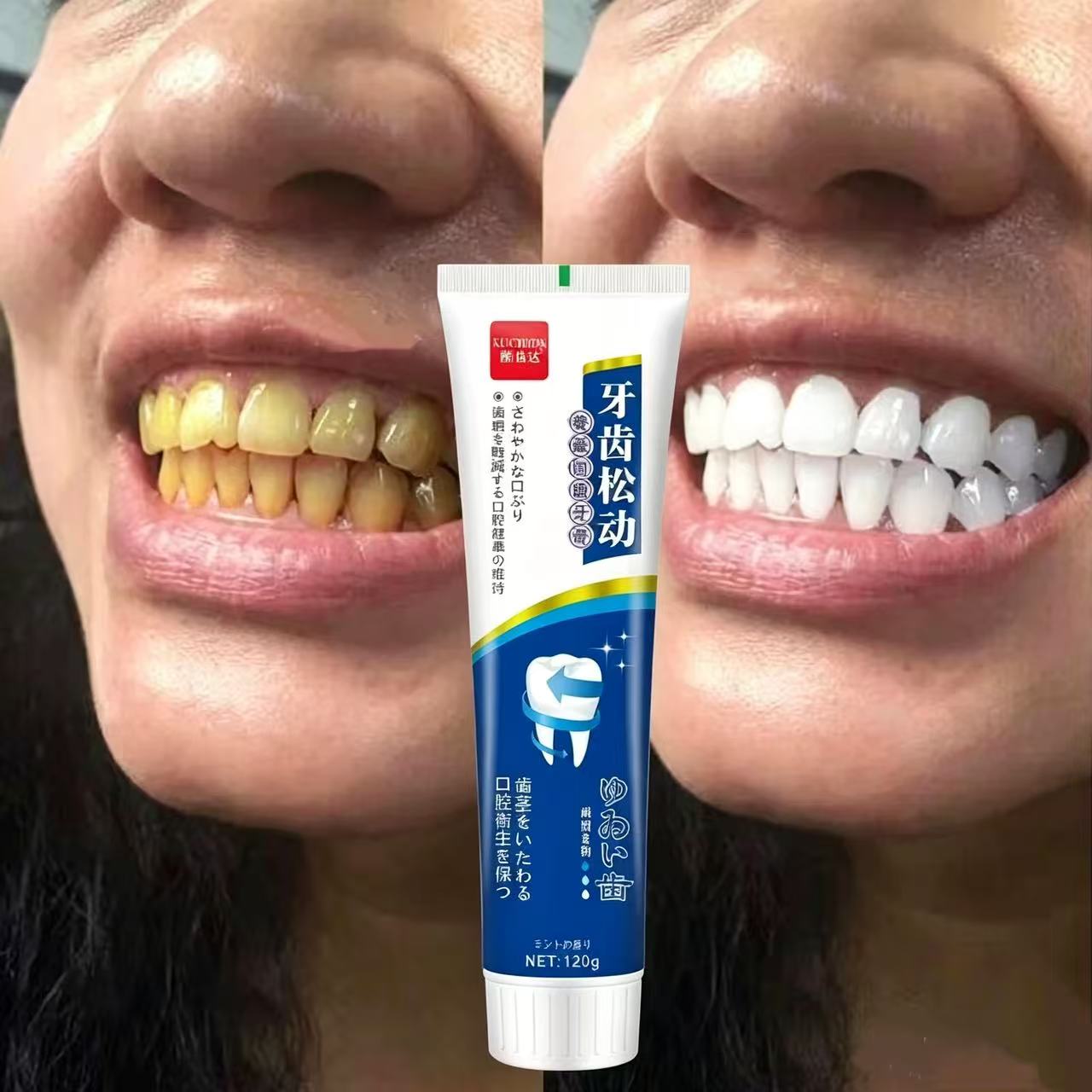 Dökülen dişleri onarıcı Japon  - Teeth Whitening Japanese incelemesi ve fiyatı