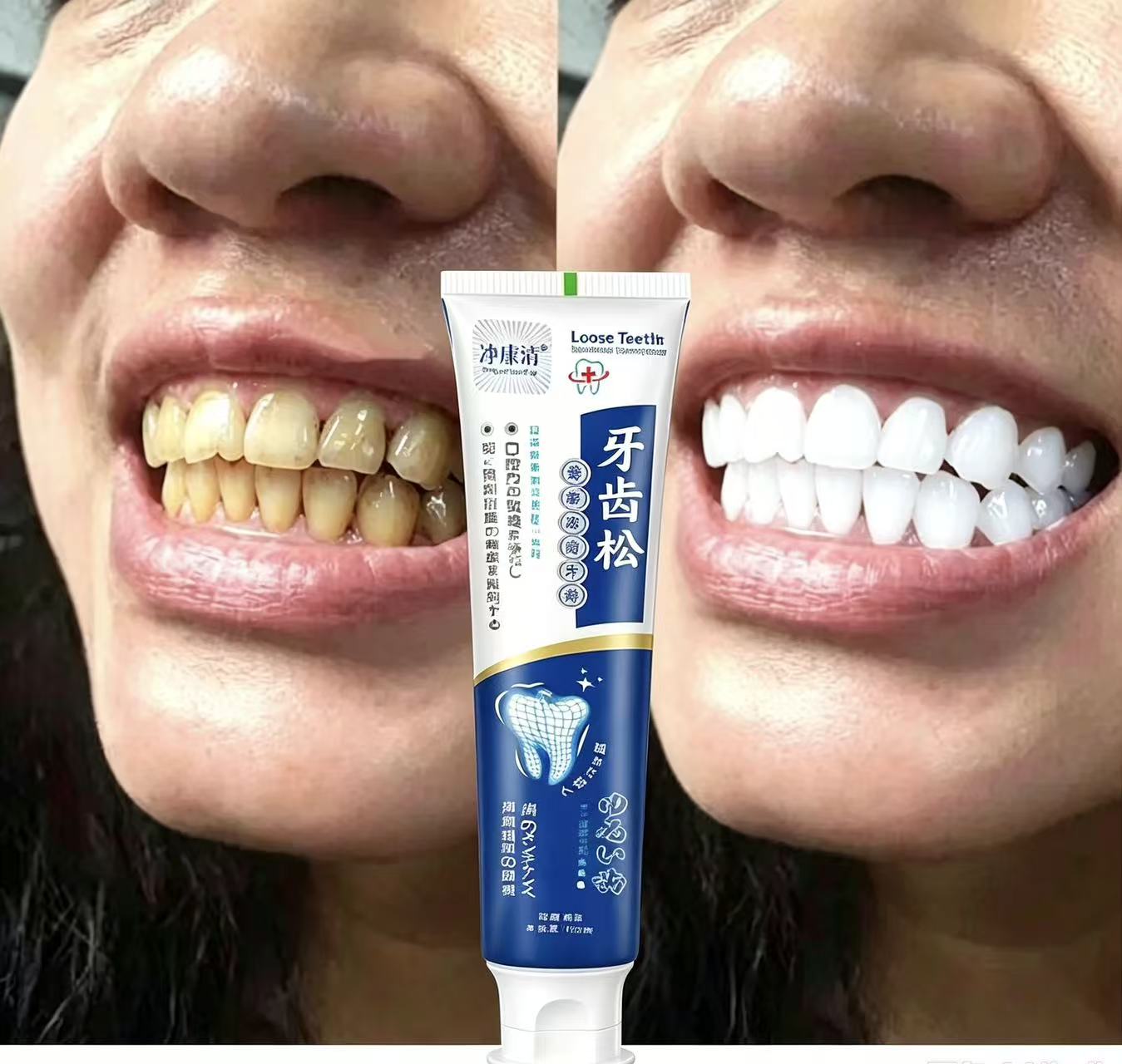 Gevşek Dişleri Onarır Japon İt - Teeth Whitening Japanese incelemesi ve fiyatı