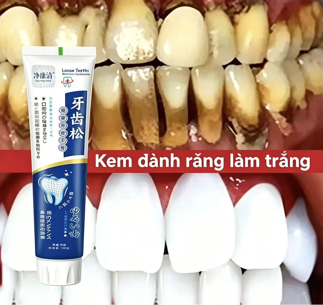 Gevşek Dişleri Onarır Japon İt - Teeth Whitening Japanese incelemesi ve fiyatı