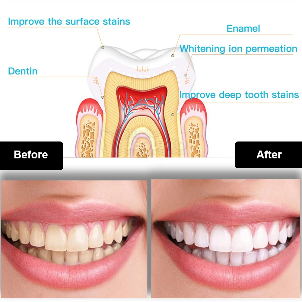 Diş Diş Beyazlatma Kiti Mini 1 - Teeth Whitening Results incelemesi ve fiyatı