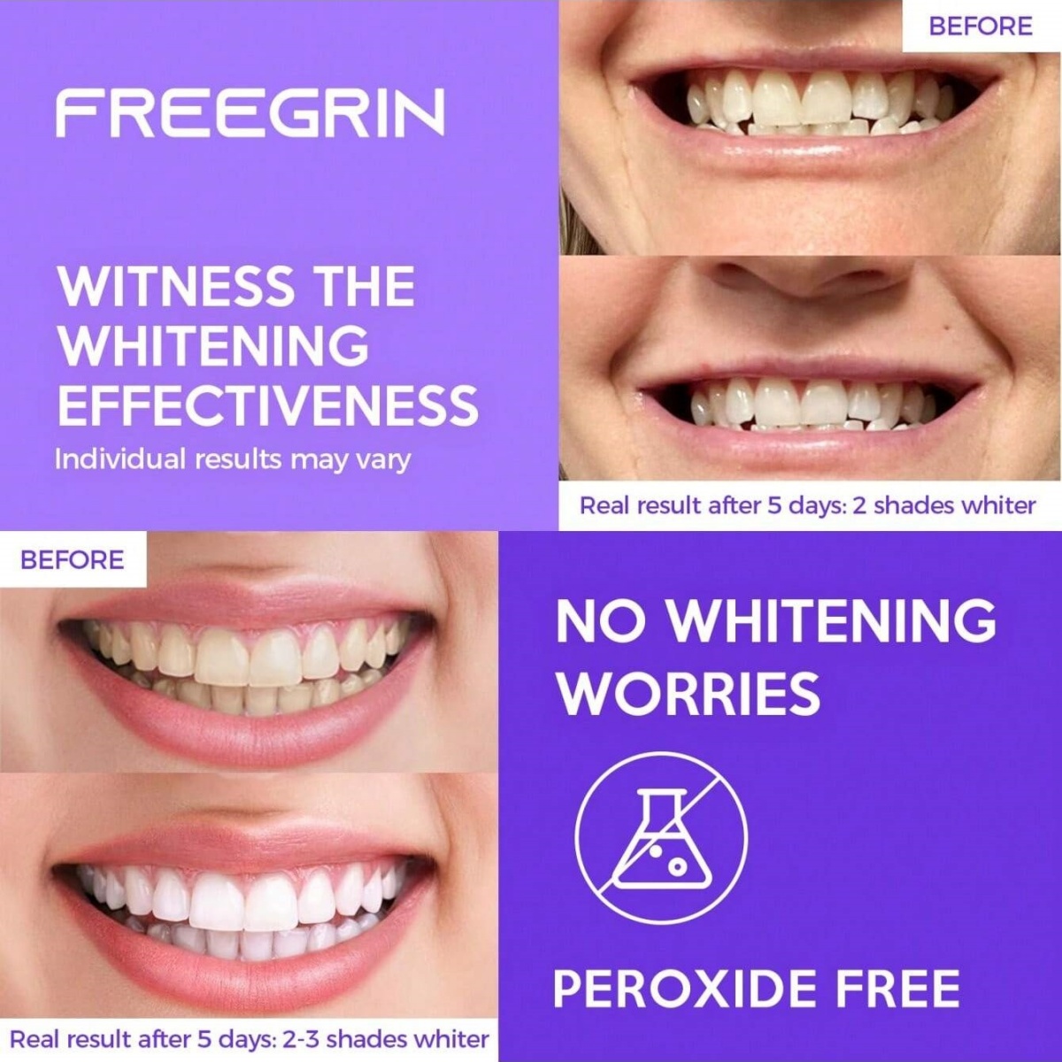 Deluxe Beyazlatma Diş Çıkartma - Teeth Whitening App incelemesi ve fiyatı